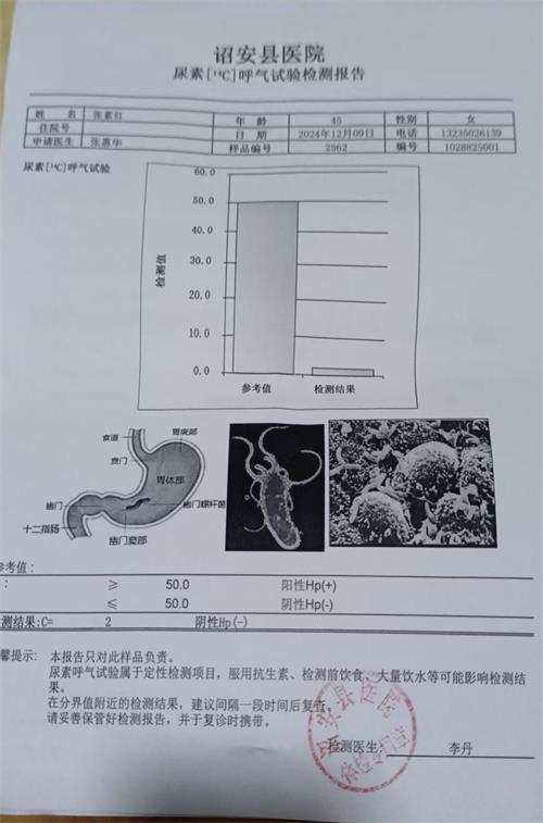 獲得其他 獲得其他